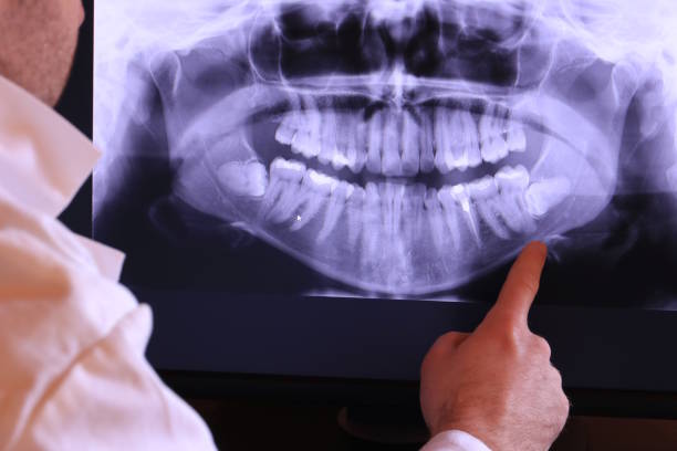 Best Orthodontic Emergency Dentist in Ramblewood, NJ