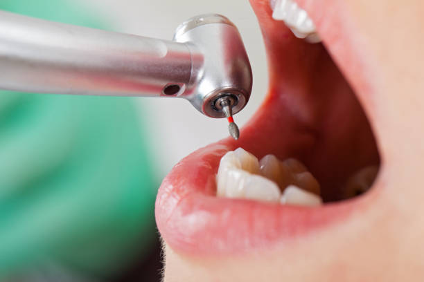 Best Pediatric Emergency Dentist in Ramblewood, NJ